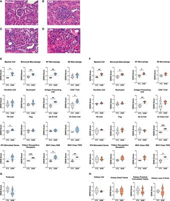 Molecular mechanisms governing the progression of nephritis in lupus prone mice and human lupus patients